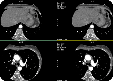 DICOM 영상 관리 (CT, X-ray 등)